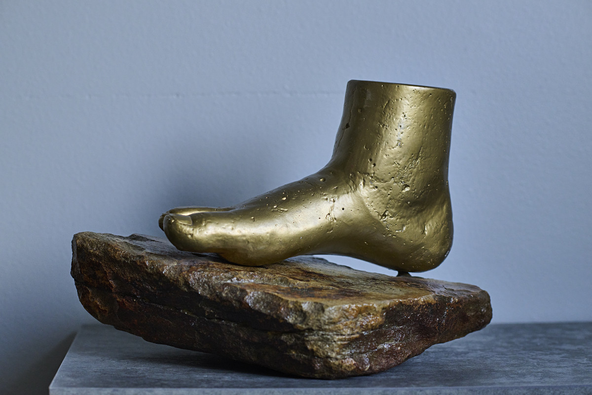 Before Thomas lost his leg, an uncle took a plaster casting of his about-to-be-amputated foot.